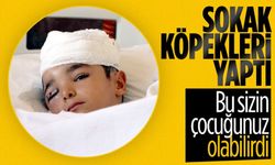 Sokak köpeği küçük çocuğun kafa derisini koparttı