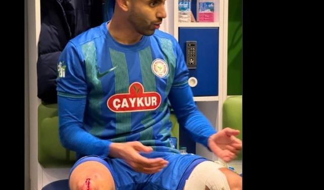 Çaykur Rizespor, Rachid Ghezzal’ın darbe alan ayağının fotoğrafını paylaştı